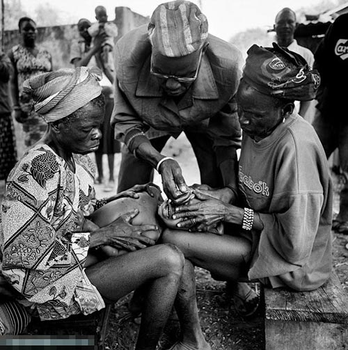 西非贝宁恐怖割皮仪式 留疤痕避免成为奴隶