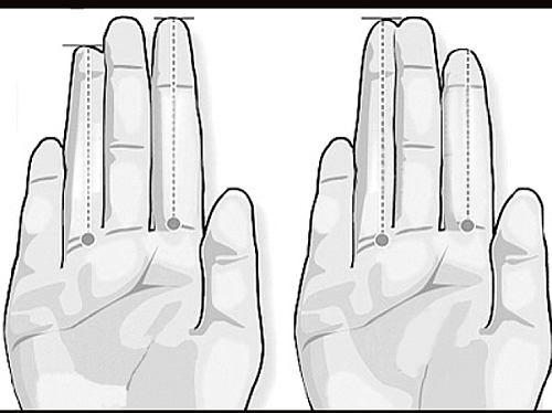 无名指和食指长度比例与其语言攻击性的强弱之间存在关联