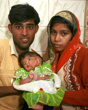 印度双面女婴被奉为神灵【图讯】