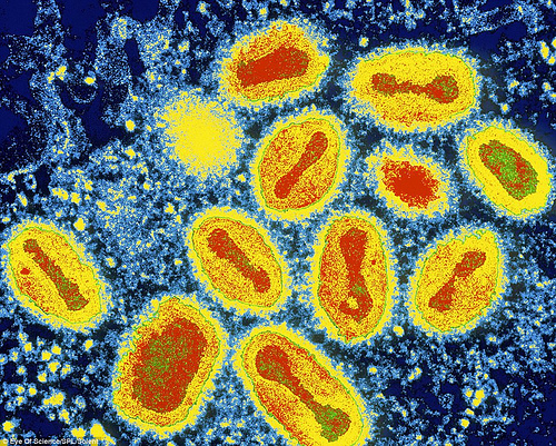 漂亮的图片 致命的病毒黑死病和炭疽病