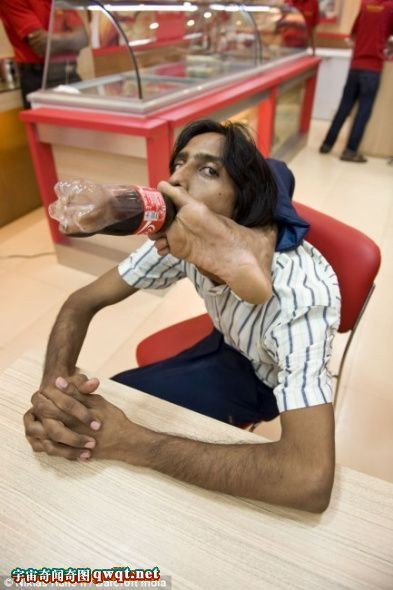 印度男孩柔韧性超惊人 可用脚趾夹着瓶子喝水