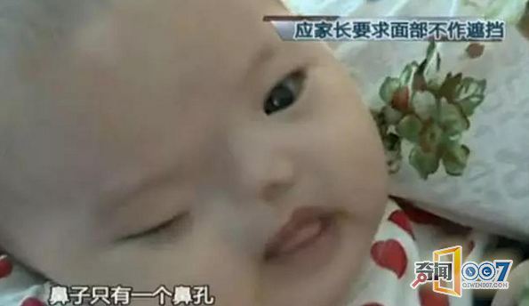 深圳女子产后被吓晕：宝宝眼鼻耳竟然都没有