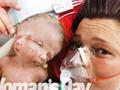 澳大利亚一名女子诞下“双脸婴” 全球有35例(图)