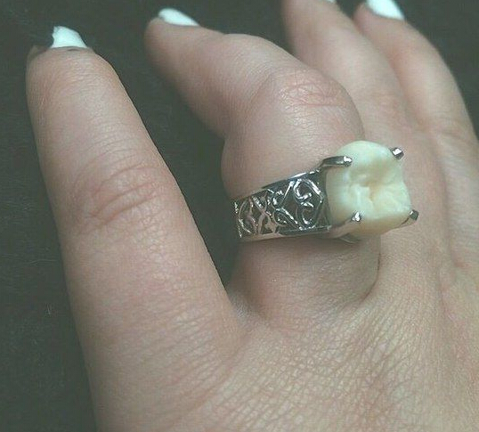 牙齿也能做成定婚戒  这样的戒指真的好吗
