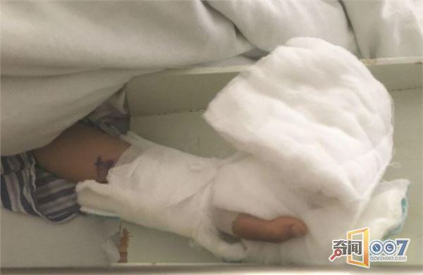 警惕！苏州10岁男孩手指被洗衣机绞断
