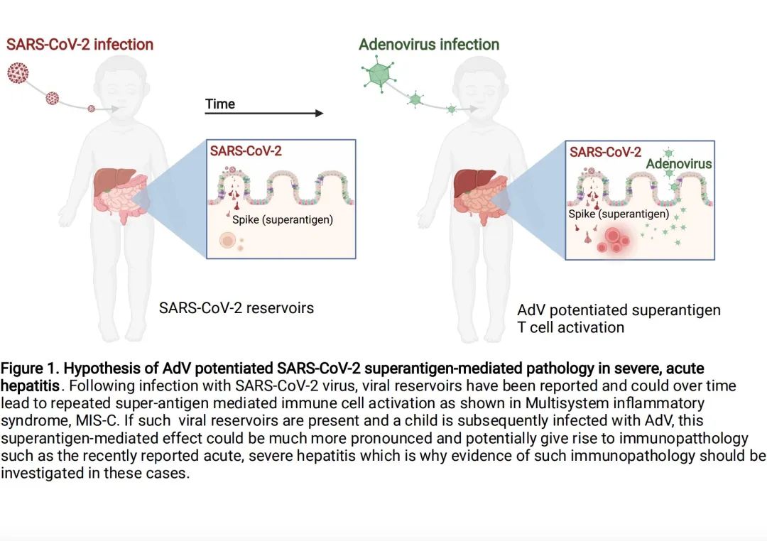 腺病毒（AdV）增强新冠病毒超级抗原介导的严重急性肝炎的病理学示意图。