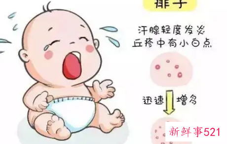 两个月的宝宝脸上出湿疹会下去吗