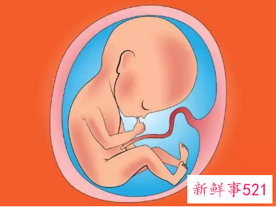 胎儿先天性疾病是怎么回事