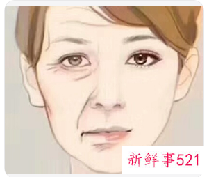 女性脸部衰老的表现