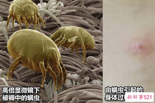 螨虫是什么？寄生在毛囊中的微小害虫(百分之九十七的人都被感染了)