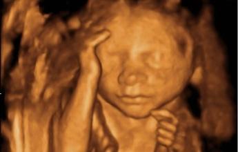 孕妈做四维彩超时，胎儿捂着脸不让看，孕妈早了解原因，少担心