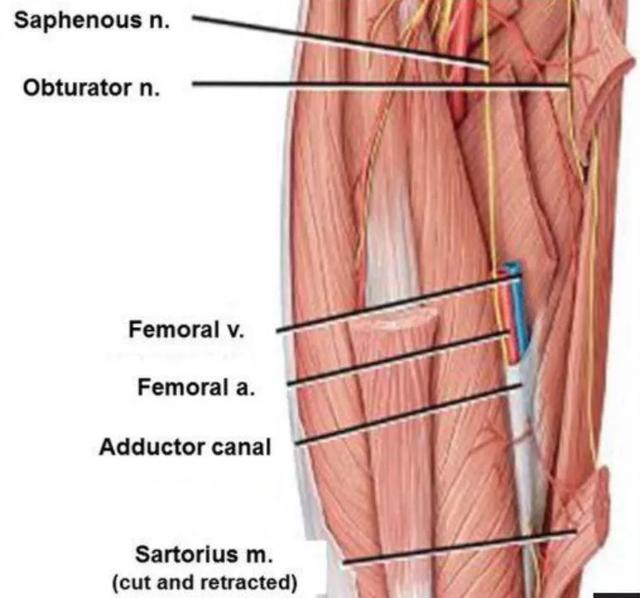 收肌管阻滞在全膝关节置换术中的应用