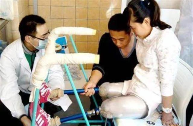 9年前，那位为救学生失去双腿的80后教师张丽莉，你还记得她吗？