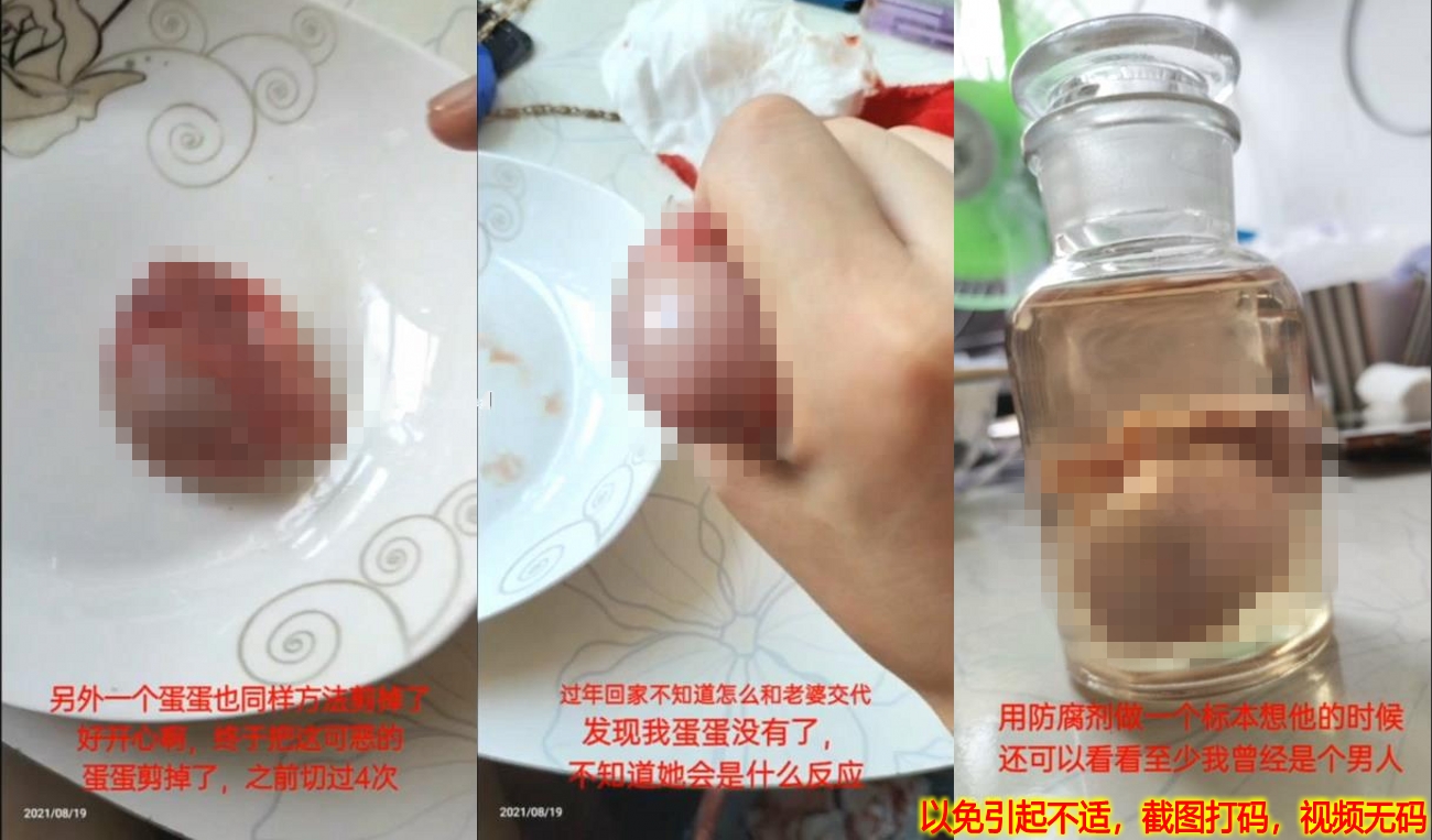高能预警！慎入！国产狠人出租屋挥刀自宫，剃须刀片将睾丸阉割切除泡福尔马林，还不知如何与老婆交代呢